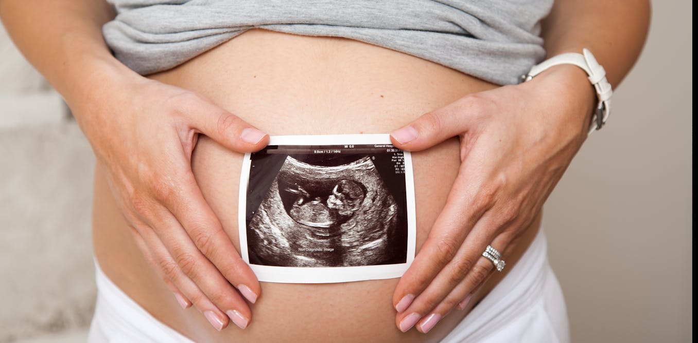 Surrogacy shake up in UK would create uneven treatment for birthmothers