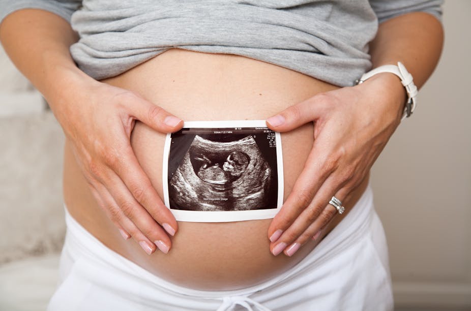Close up of pregnant woman holding ultrasound scan on her tummy.