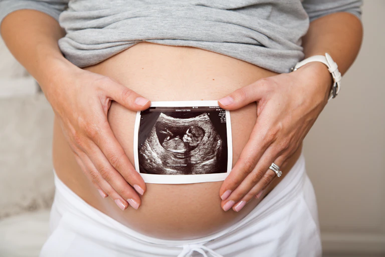 Close up of pregnant woman holding ultrasound scan on her tummy.