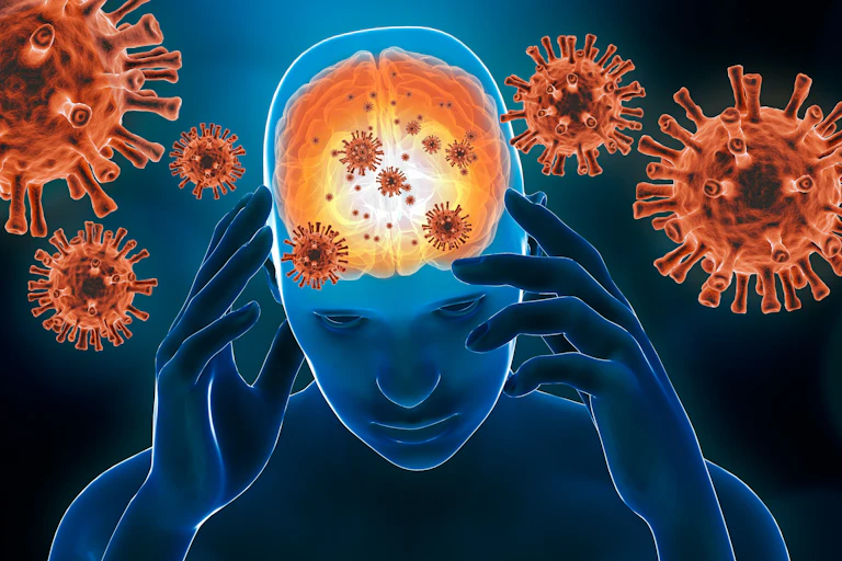 Ilustración 3D de inflamación cerebral con células de virus.