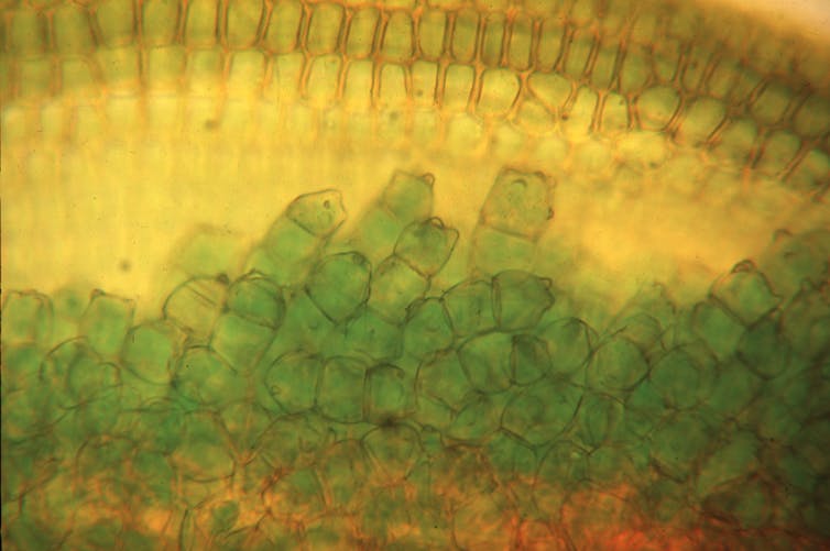 Papillae on the leaf of the moss Crossidium davidai.David Eldridge, Author provided