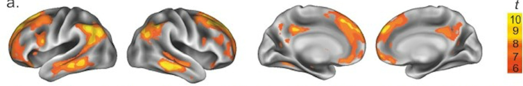 El cerebro de las mujeres embarazadas experimenta toda una serie de cambio que enumeramos en este artículo firmado por científicos.