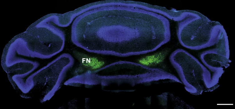 une image en fluorescence du cerveau