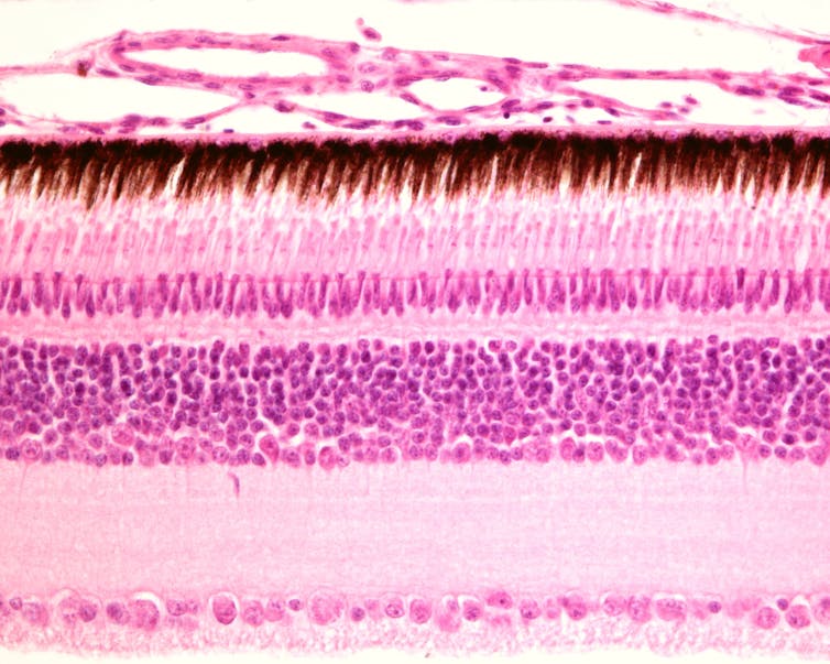 microscopic layers of the eye's retina. Pink dotted structure