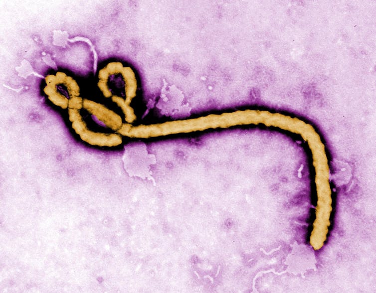 Virus del Ébola.