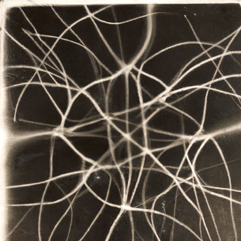 Networks of silver nanowires seem to learn and remember, much like our brains