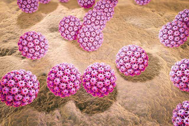 Oral sex is now the leading risk factor for throat cancer