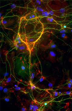 Microscopy image of an interneuron