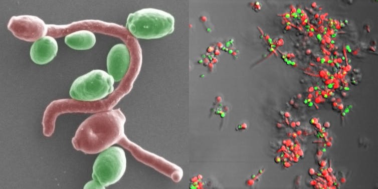 Microscopy image of two types of Candida attaching to each other