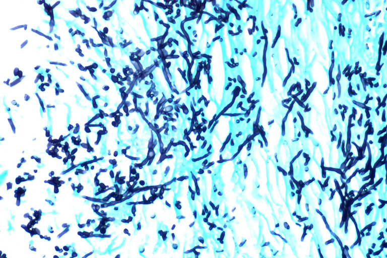 Microscopy image of budding Candida infection
