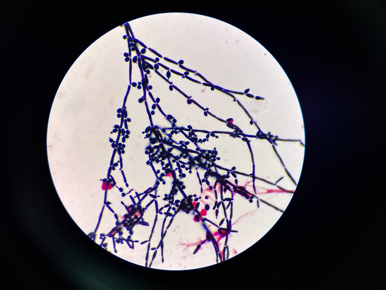 Microscopy image of budding yeast cells