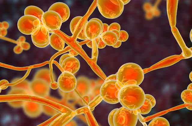 A close up illustration of Candida auris, a type of fungus, showing orange branches with small spheres at the end of each branch, against a black background.