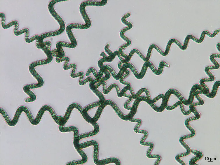Une dizaine de longs filaments verts, chacun formant un serpentin ou une spirale