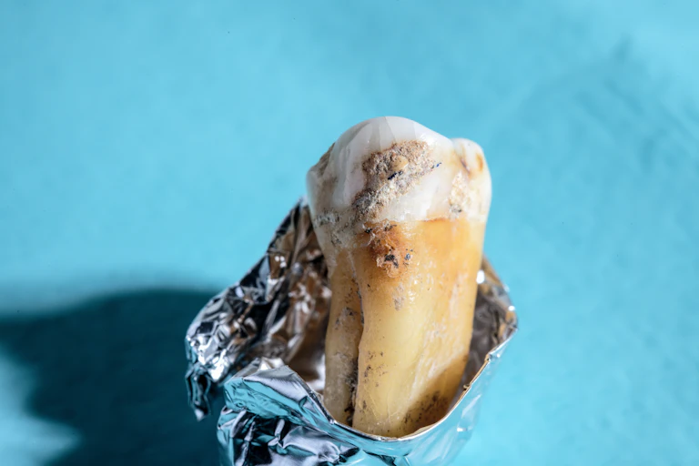 Close-up of ancient tooth in metal foil container