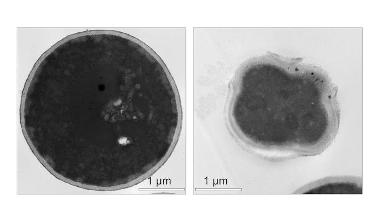 Two black and white electron microscopy images of a fungal cell.  The left image shows a large, round, healthy cell, while the cell on the right has shrunk after treatment with mildly activated molecular machines.