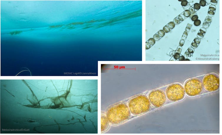 Four images of Melosira arctica algae.