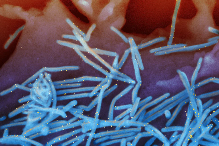 Scanning electron micrograph of human respiratory syncytial virus