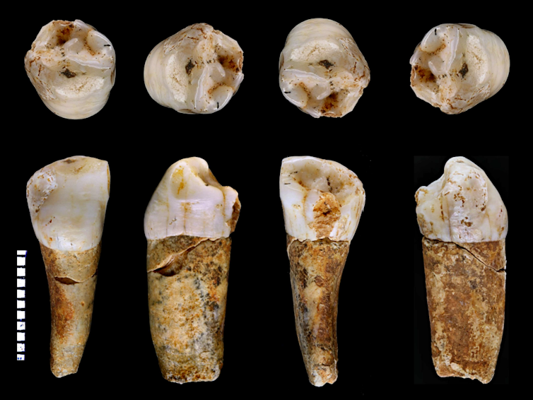 A Neanderthal premolar tooth from the Almonda cave system, Portugal (seen from different angles).