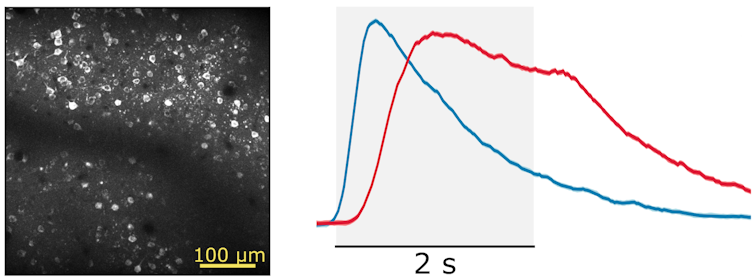 schéma et photo de microscopie