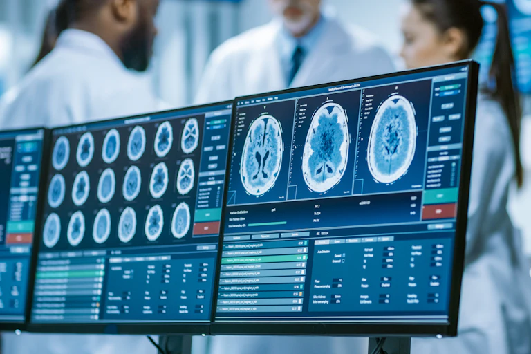 MRI scans on a screen.