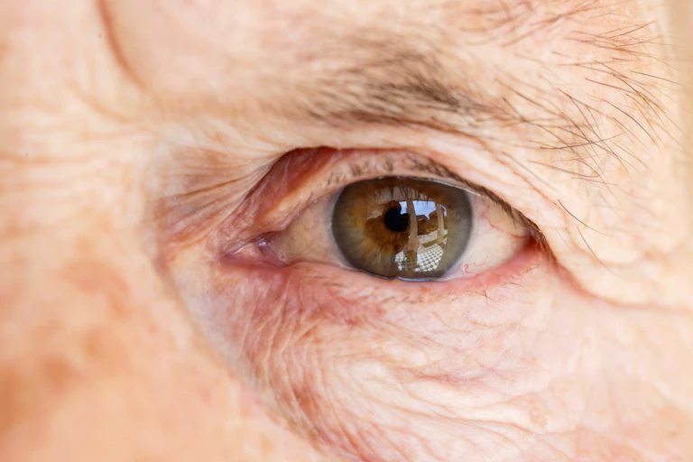 Close up of a person's eye