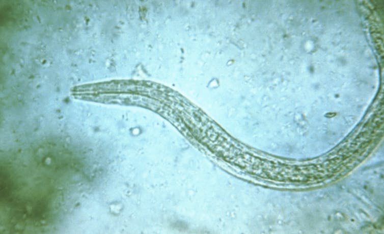 A snakelike object is visible amid random specks. A microscopic image of a human hookworm.