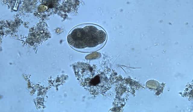 A cluster of dark circles is surrounded by formless blobs.