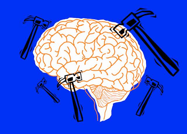 Illustration of hammers knocking on a brain