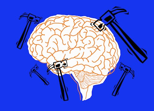 Chronic pain can be objectively measured using brain signals – new research