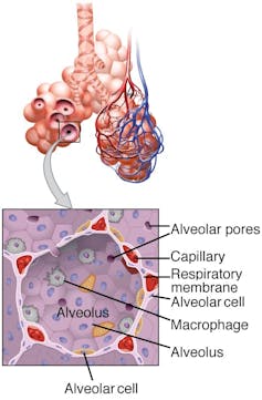 Illustration of a small section of lungs showing the alveoli and, within the alveoli, a close up of a microphage