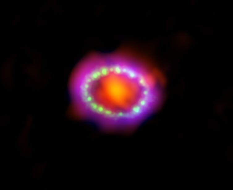 La Supernova 1987A.  Esta composición contiene imágenes de rayos X de Chandra en azul, datos de luz visible de Hubble en verde y datos de longitud de onda submilimétrica de ALMA en rojo.