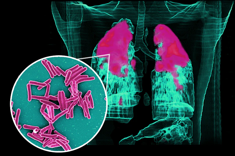 Image en microscopie électronique de M. tuberculosis