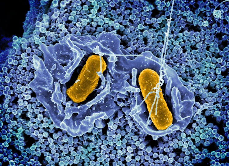 Microscopy image of Salmonella Typhimurium invading a human epithelial cell