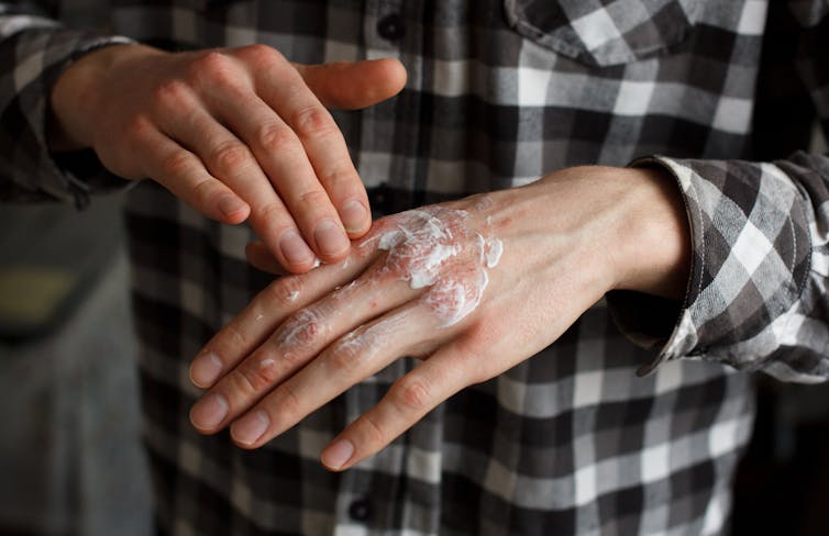 person rubs white skin cream on to hand