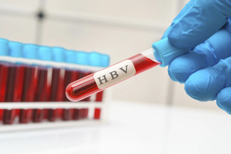 Hand in blue glove holding a test tube labelled HBV