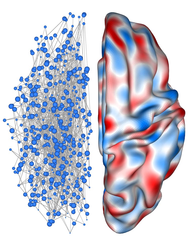 An illustration of a brain, showing one half as a web of dots and lines, and the other as a convoluted surface with wave patterns regions shaded red and blue.