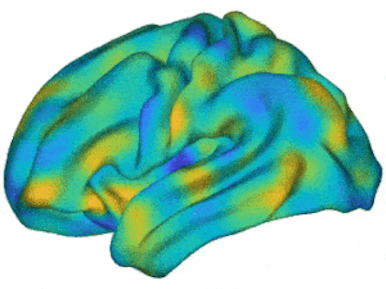 An animation showing multicoloured waves of activity propagating around the brain.