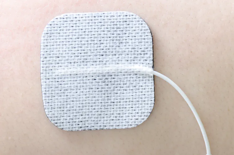 Sticky pad of TENS machine on skin