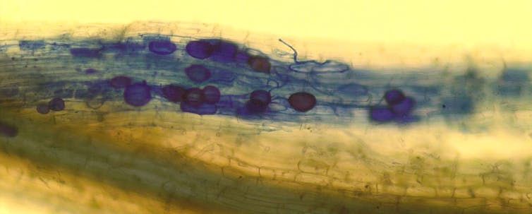 Microscope image of plant roots that have been stained to show the mycorrhizal fungal inside the root of a plant.