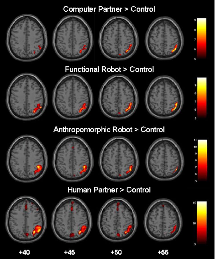 Cartes du cerveau avec des régions plus ou moins activées