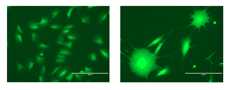 Microscopy images of ovarian epithelial cells before and after chronic arsenic exposure