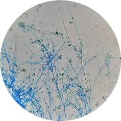 Hifas y esporas de 'Trichoderma harzianum' vistas al microscopio.