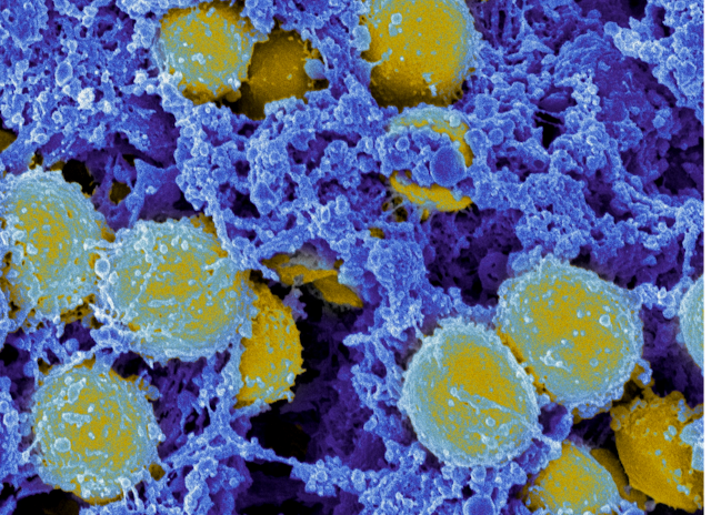 Microscopic view of methicillin-resistant Staphylococcus aureus bacteria