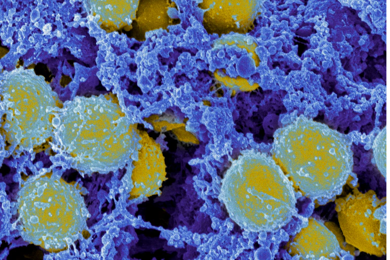 Microscopic view of methicillin-resistant Staphylococcus aureus bacteria