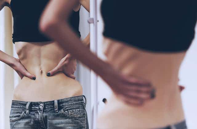 Mujer joven con anorexia mirándose en el espejo