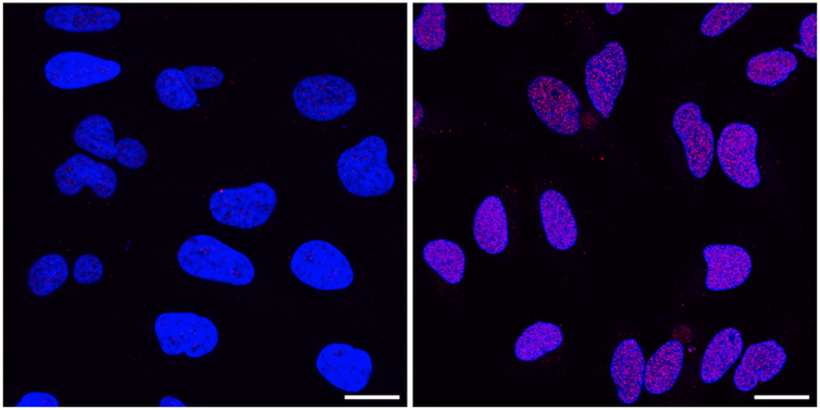 deux photos de microscopie