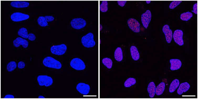 deux photos de microscopie