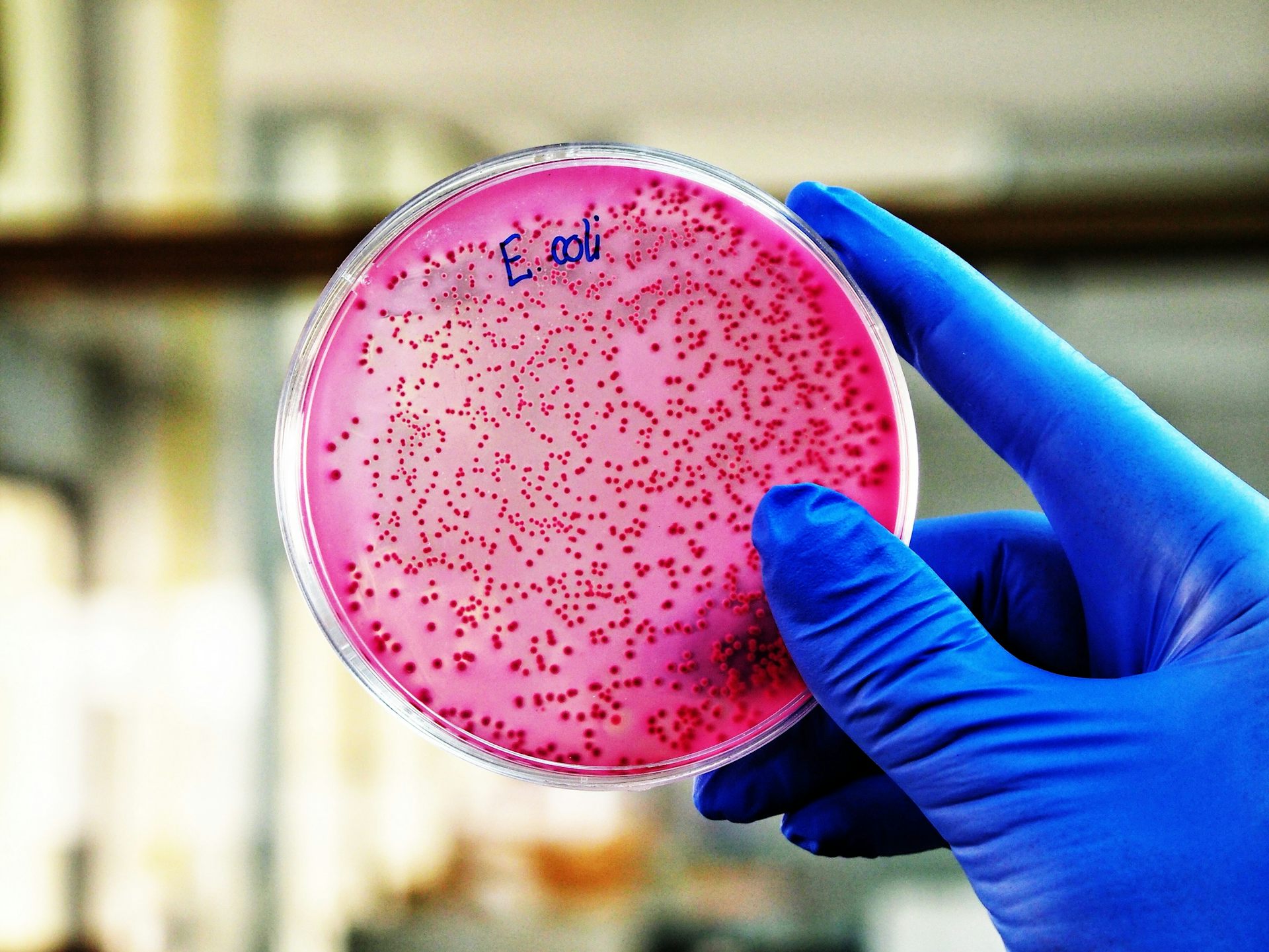 El perfil bueno de ‘E. coli’, la bacteria que ha ayudado a ganar (al ...