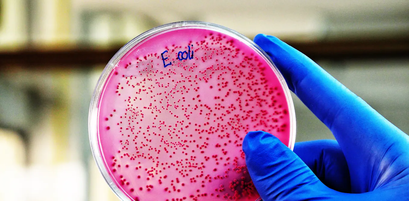 El perfil bueno de ‘E. coli’, la bacteria que ha ayudado a ganar (al ...