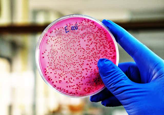 Una placa de laboratorio con un cultivo de E. coli.